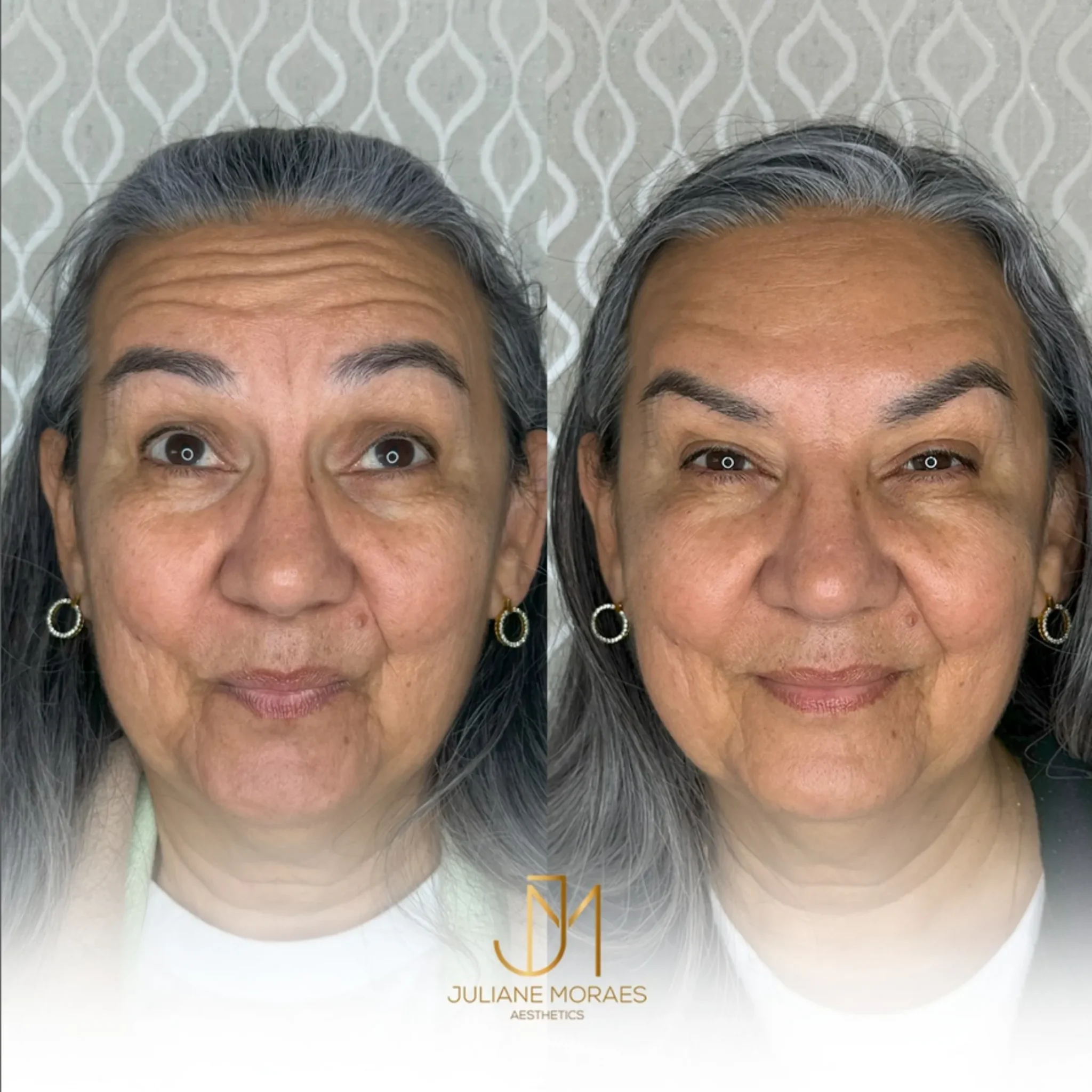 Design sem nome (56)_11zon