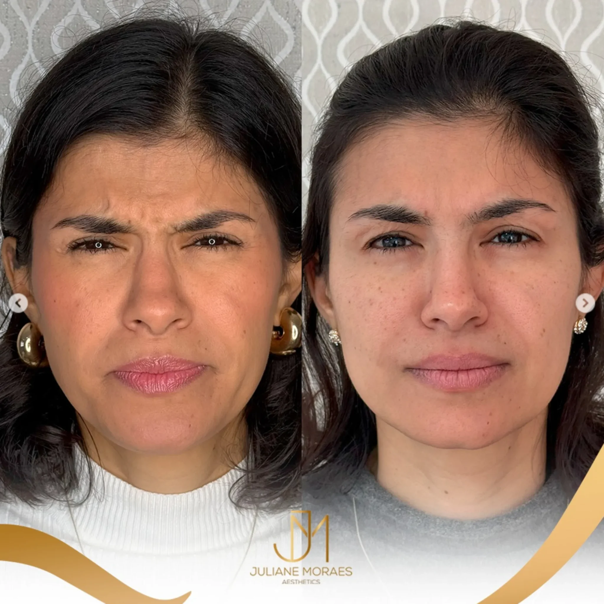 Design sem nome (62)_11zon