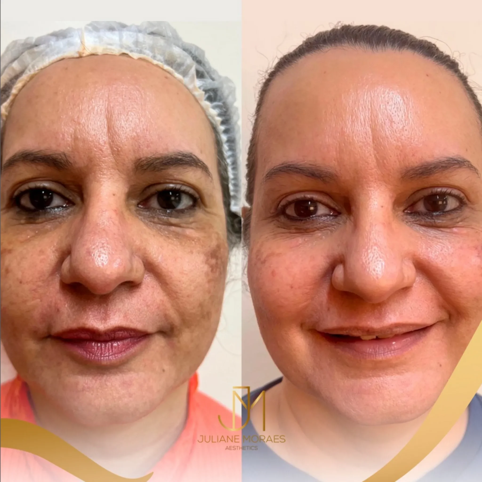 Design sem nome (74)_11zon