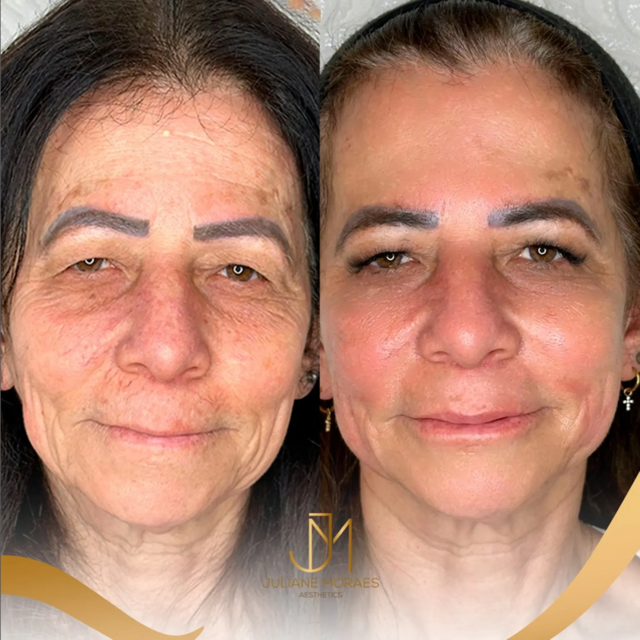 Design sem nome (75)_11zon