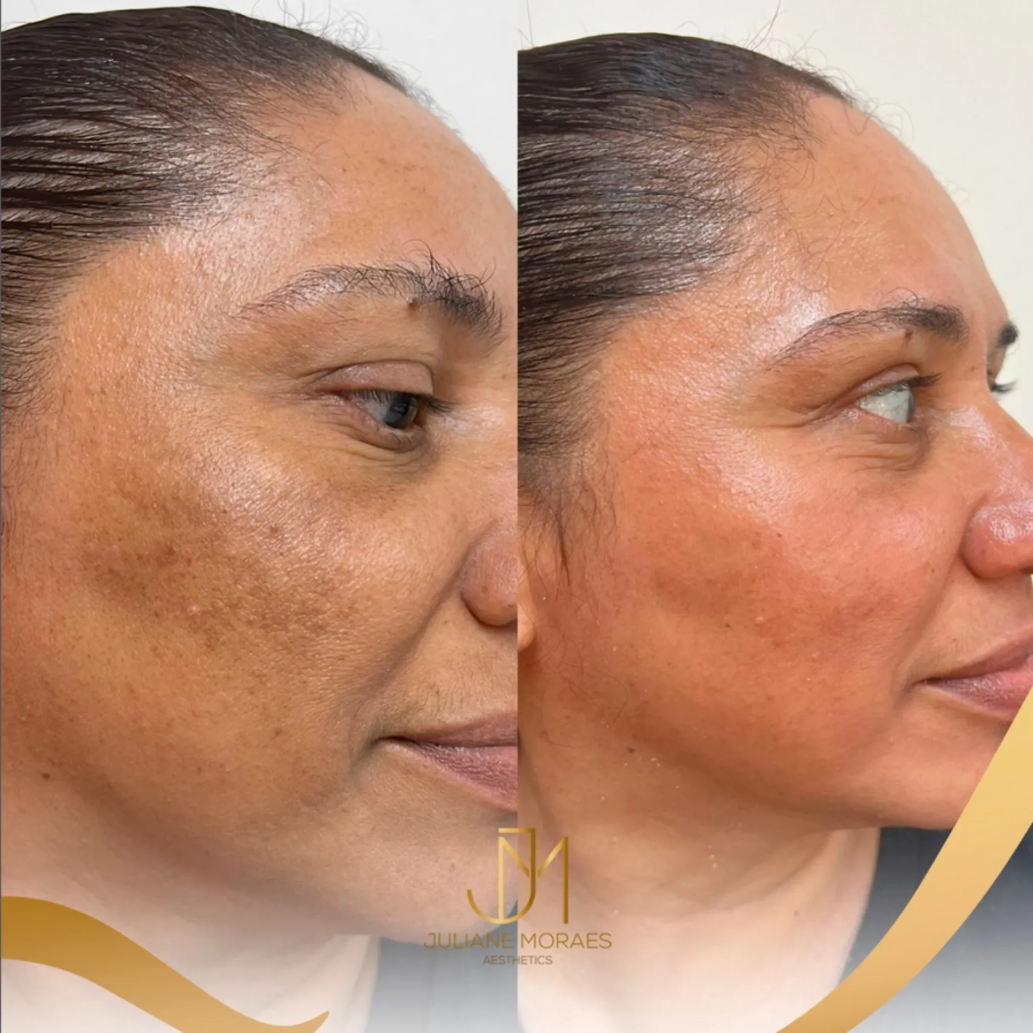 Design sem nome (77)_11zon